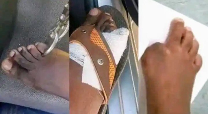  ZIMBABWEANS SELLING TOES $20,000 AMID HIGH COST OF LIVING